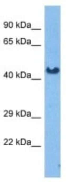 Pregnancy Specific beta-1-glycoprotein 7 Rabbit anti-Human, Polyclonal,